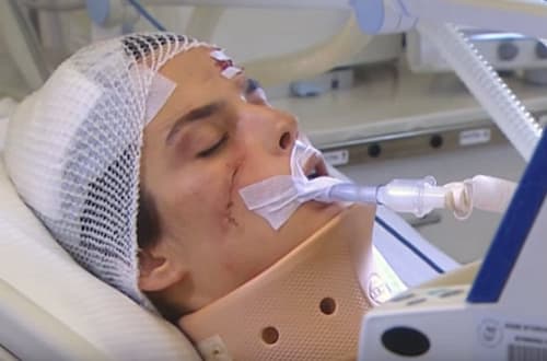 Izgubljena ljubav – 24. epizoda – Nermin reanimiraju!